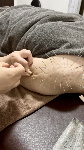 鍼処 心-shin-のこだわりポイント