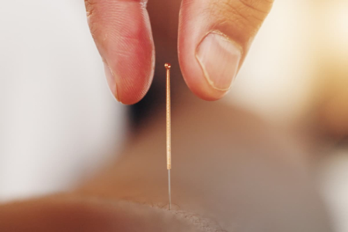 静ごころ鍼灸院のこだわりポイント