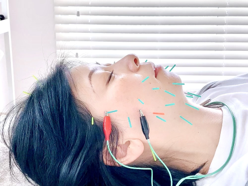 はり灸サロン　totonoiのこだわりポイント