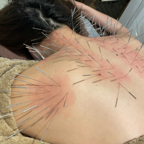 鍼処北風　飯田橋院のこだわりポイント