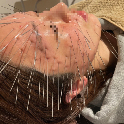 鍼処北風　飯田橋院のこだわりポイント