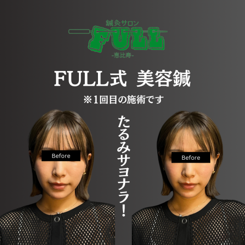 鍼灸サロンFULL恵比寿のこだわりポイント