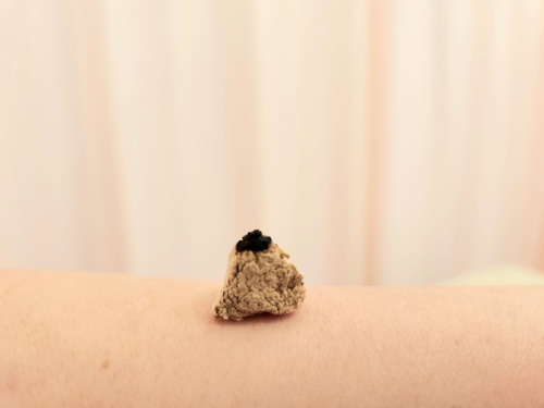 すずなり鍼灸院のこだわりポイント