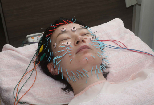 おべ鍼灸院のこだわりポイント