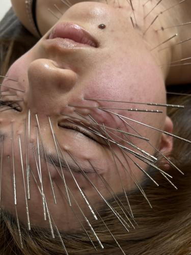 鍼秋田別院〜ルート治療専門院〜のこだわりポイント