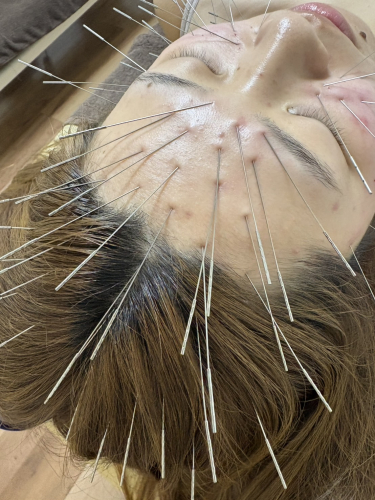 鍼秋田別院〜ルート治療専門院〜のこだわりポイント