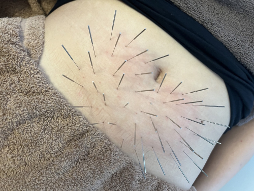 鍼秋田別院〜ルート治療専門院〜のこだわりポイント