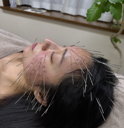 鍼灸サロン　月と恵のこだわりポイント