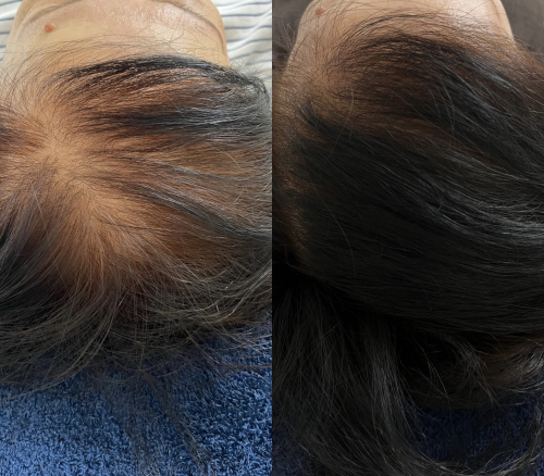 せせらぎ鍼灸院　ルート治療のこだわりポイント