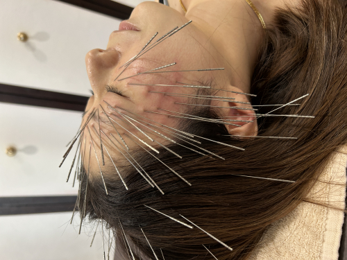 鍼灸サロンAy'sのこだわりポイント