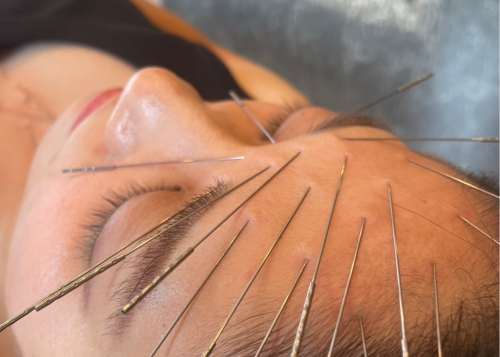 ここゆ鍼灸院のこだわりポイント