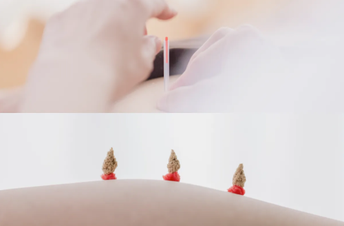 ７０１　鍼灸マッサージ院のこだわりポイント