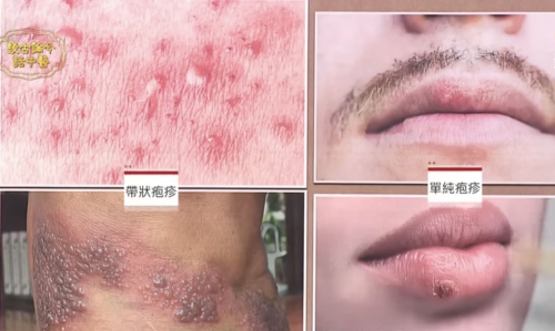 はり灸恩宝堂のこだわりポイント