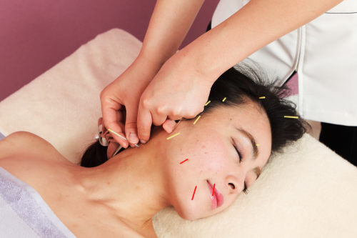 美容鍼灸ビハリスト 麻布十番のこだわりポイント