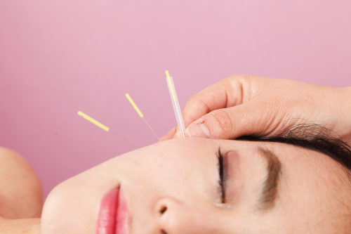 美容鍼灸ビハリスト 吉祥寺のこだわりポイント