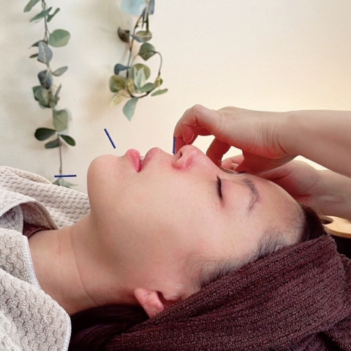 Milagroミラグロはり灸院　おんねつ・鍼灸・美容鍼灸のこだわりポイント