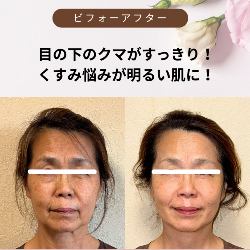 Milagroミラグロはり灸院　おんねつ・鍼灸・美容鍼灸のこだわりポイント