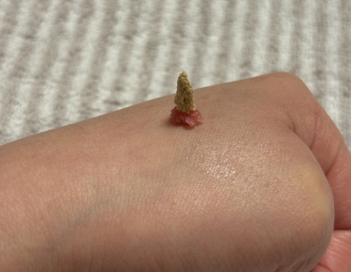 鍼灸院Lilyのこだわりポイント