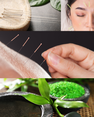 鍼処NAOTO　宮崎市出張所のこだわりポイント