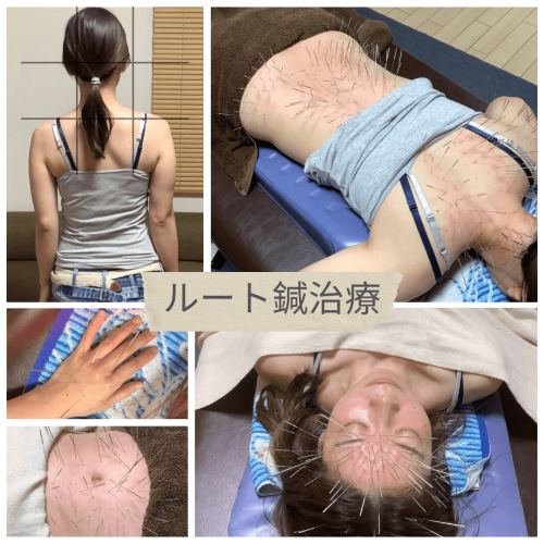 ゆず鍼灸治療院のこだわりポイント