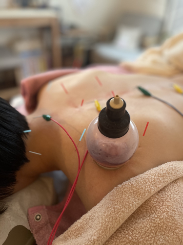 治療院 しらたま鍼灸吸玉サロンのこだわりポイント