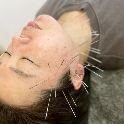 やまもと鍼灸整骨院(ルート治療）和泉市のこだわりポイント