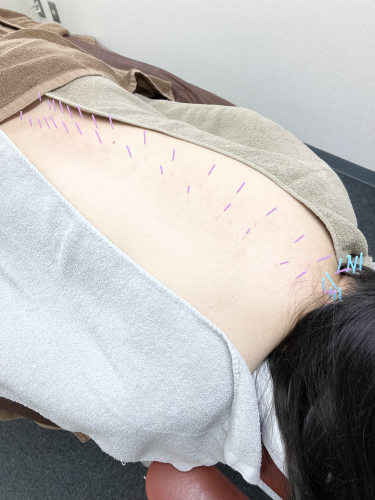 サボテン鍼灸マッサージ院のこだわりポイント