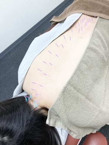 サボテン鍼灸マッサージ院のこだわりポイント