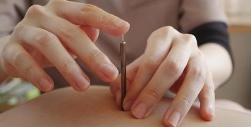 solaceスポーツ鍼灸整骨院のこだわりポイント