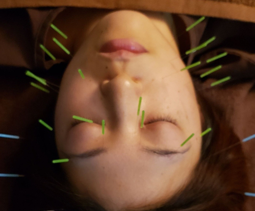 鍼灸サロン 悠雲のこだわりポイント