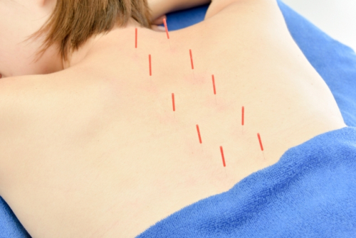 鍼灸サロンKanaloaのこだわりポイント