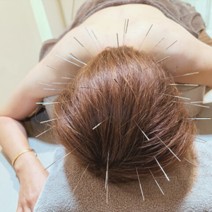  【京都四条烏丸】美容鍼灸サロン龍ノ穴（ルート治療認定院）のこだわりポイント