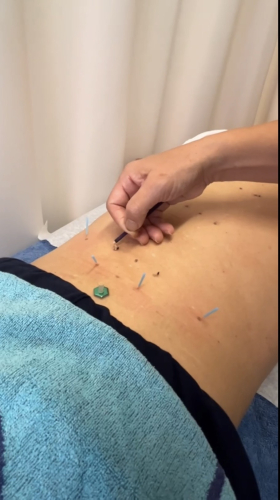 東洋堂梅園鍼灸治療院のこだわりポイント