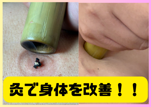 鍼灸明（あかり）のこだわりポイント