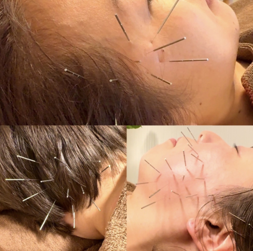 はり灸こころねのこだわりポイント