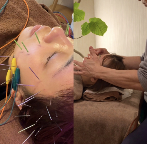 はり灸こころねのこだわりポイント