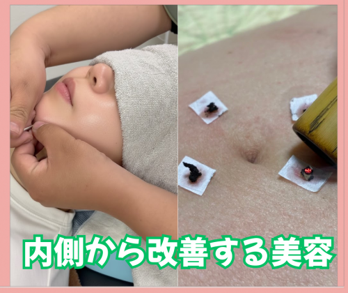 鍼灸明（あかり）のこだわりポイント