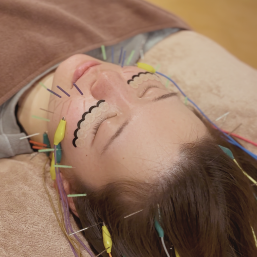 うぃず鍼灸整骨院のこだわりポイント