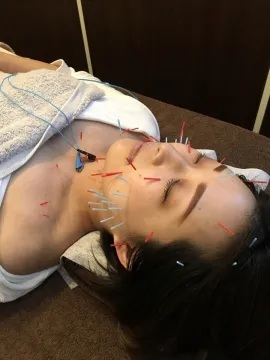 form美容鍼灸院　八丁堀店のこだわりポイント
