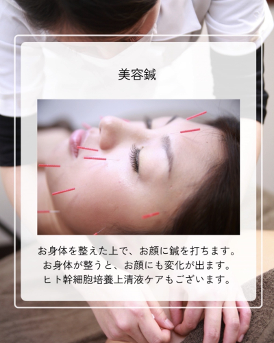 鍼灸　スノルノのこだわりポイント