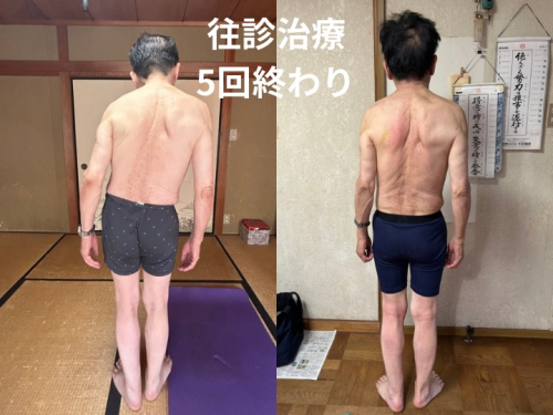 鍼処KAKUREGAのこだわりポイント