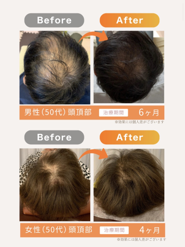 いいとこ鍼灸院のこだわりポイント