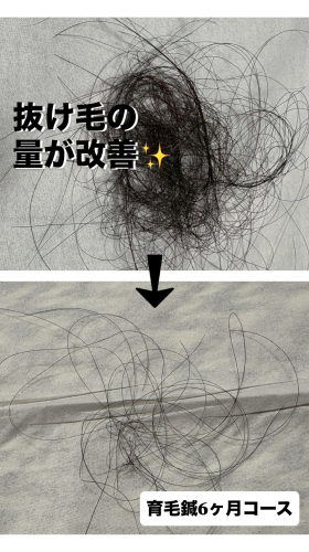 いいとこ鍼灸院のこだわりポイント