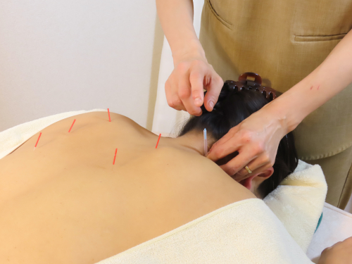 表参道鍼灸サロンゆたかのこだわりポイント