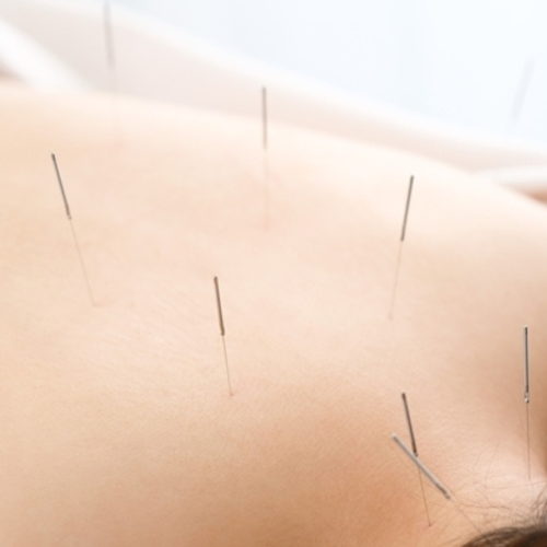 鍼灸整体慈康院のこだわりポイント