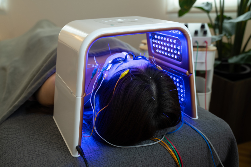 【電気を流す美容鍼】あかり鍼灸接骨院のこだわりポイント