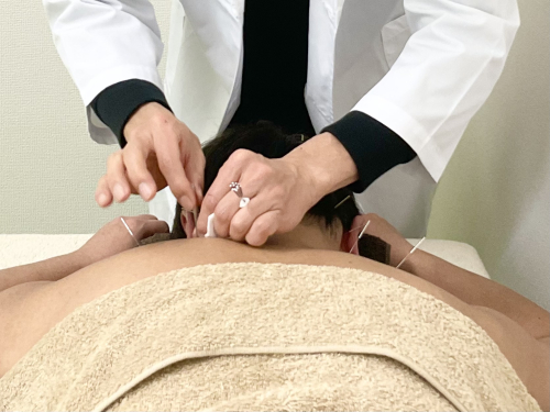 青山はり治療院のこだわりポイント