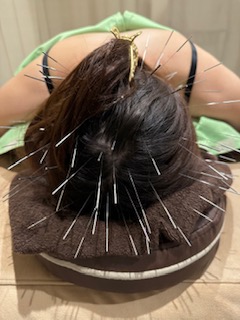 totonou鍼灸治療院のこだわりポイント