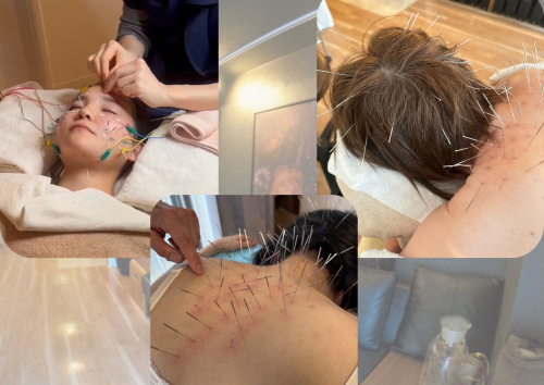 美容鍼灸サロン マックスビューティーのこだわりポイント