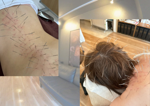 美容鍼灸サロン マックスビューティーのこだわりポイント